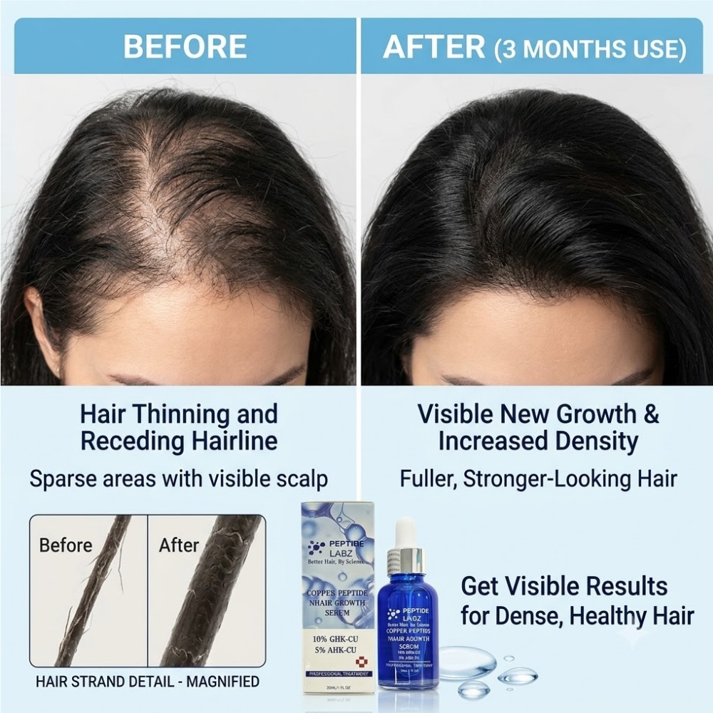 Hair Growth Essence Copper Pep - đánh giá và giá Peptide Complex Serum