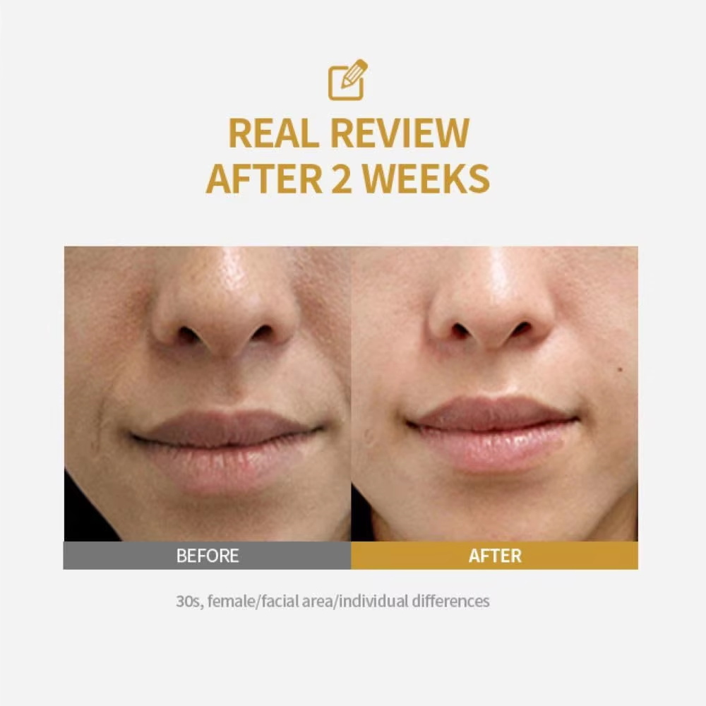 Peptide Intensive Lifting Ampo - đánh giá và giá Peptide Complex Serum