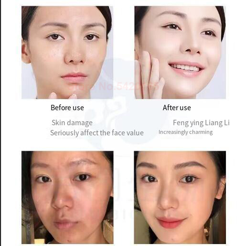 0.25 mm Microneedle GHK-Cu Blu - đánh giá và giá Peptide Complex Serum